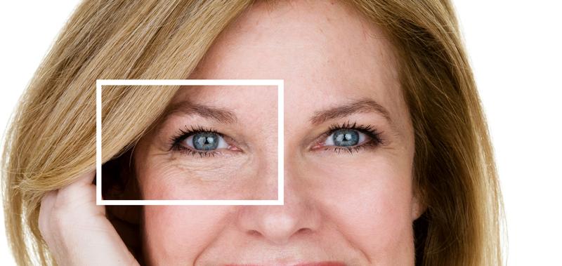 Setting your sights on eye treatments